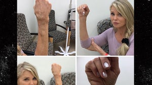Christie Brinkley Shares Gnarly Images of 'DWTS' Wrist Injury