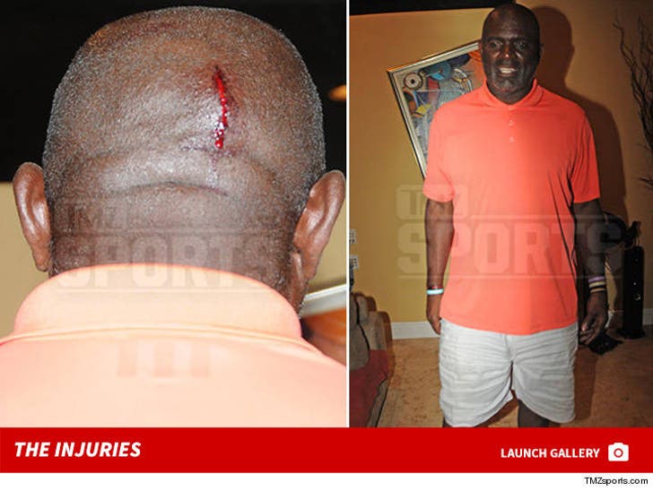 Lawrence Taylor -- Bloody Injuries After Wife's Domestic Violence Arrest
