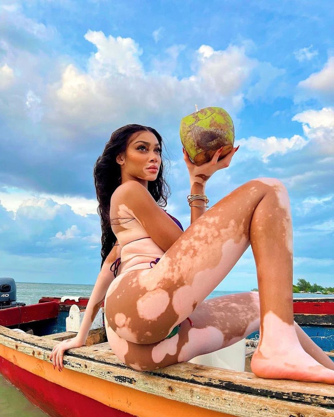 Winnie Harlow