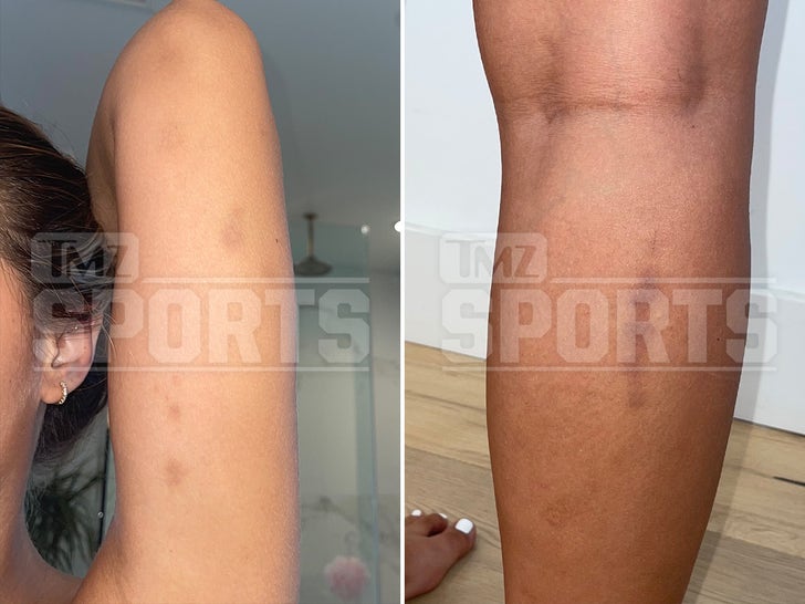 Sofia Jamora's alleged injuries