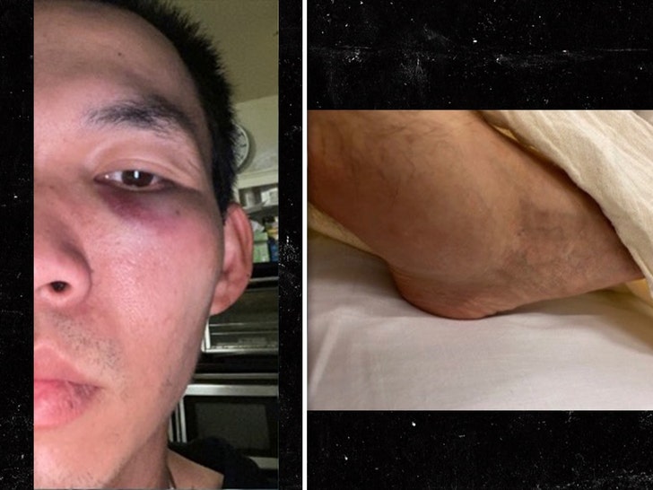 WATCH: UPS DRIVER ATTACKED ON SAN FRAN STREET … Attacker Gets Instant Karma!!!