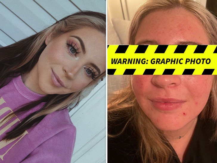 Woman Gets Eyelid Ripped Off By Dog -- The Graphic Photos