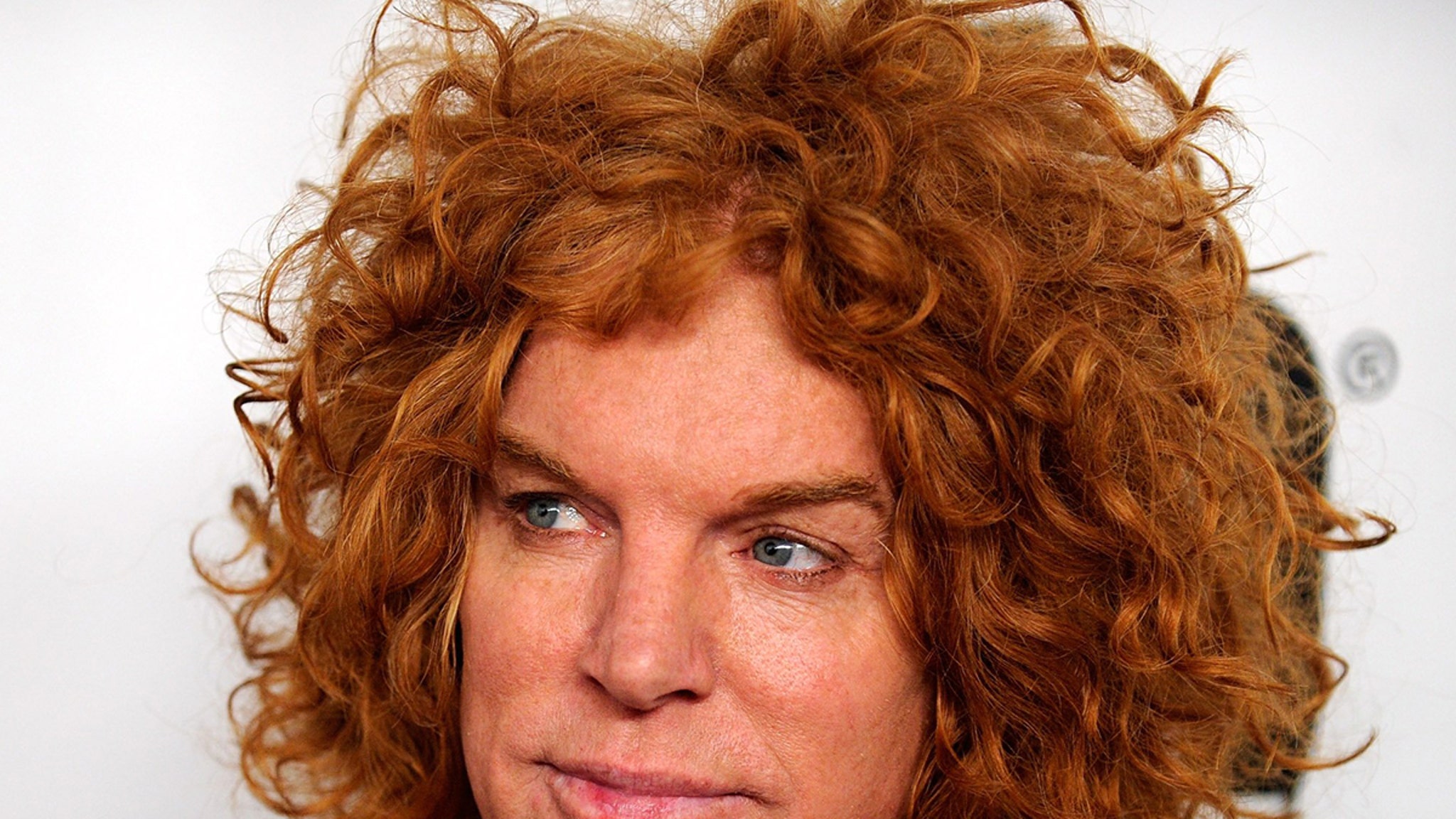 Carrot Top Is Now Awake, Breathing On His Own