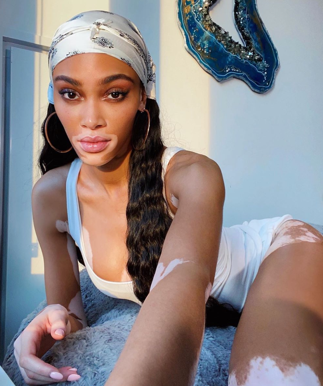 winnie harlow hot Shots 1