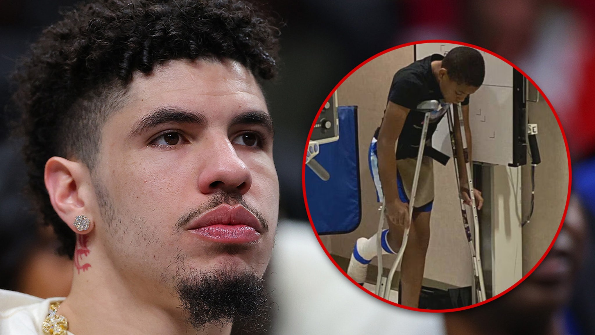 LaMelo Ball Sued After Allegedly Driving Over, Breaking Foot Of Young Fan