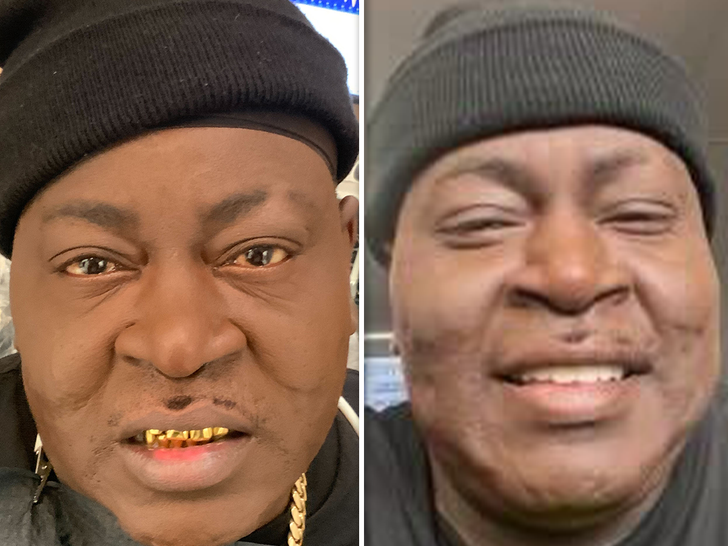 Tricky Daddy -- Gets 30 Year Old Gold Teeth Taken Out