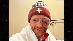 Bare Knuckle Boxing's Nathan Decastro Shows Gruesome Eye Injury After Fight