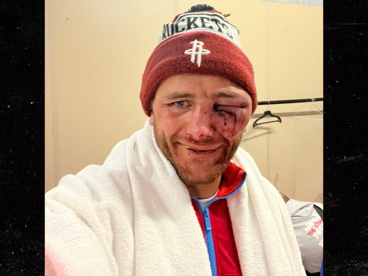 Çıplak Knuckle Boxing'den Nathan Decastro, Dövüşten Sonra Korkunç Göz Yaralanması Gösteriyor