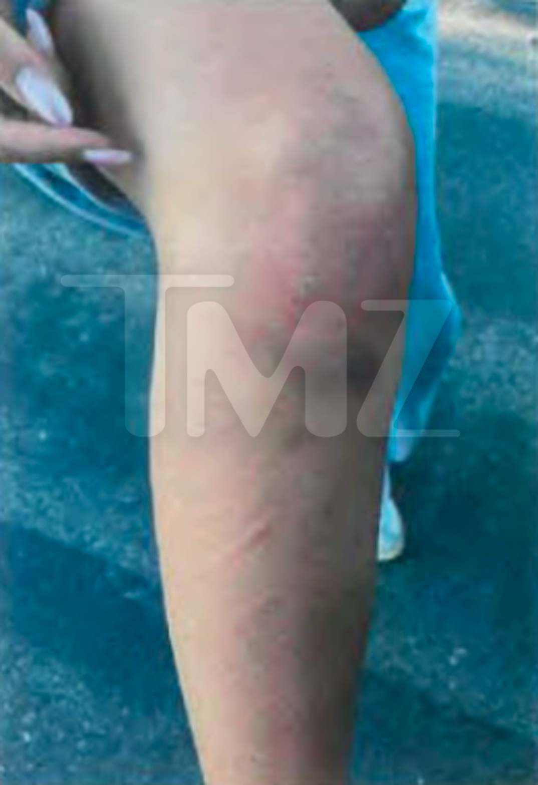 Maria Lafuente Injuries 0