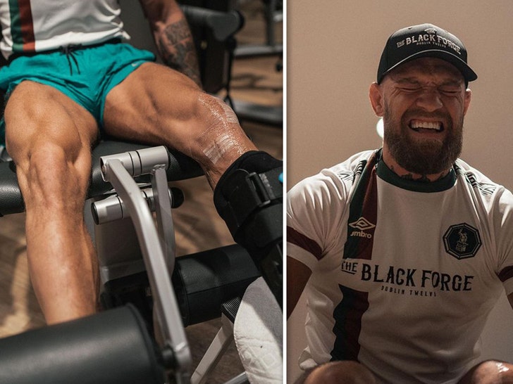 Conor McGregor Back In Gym 3 Weeks After Gnarly Leg Surgery