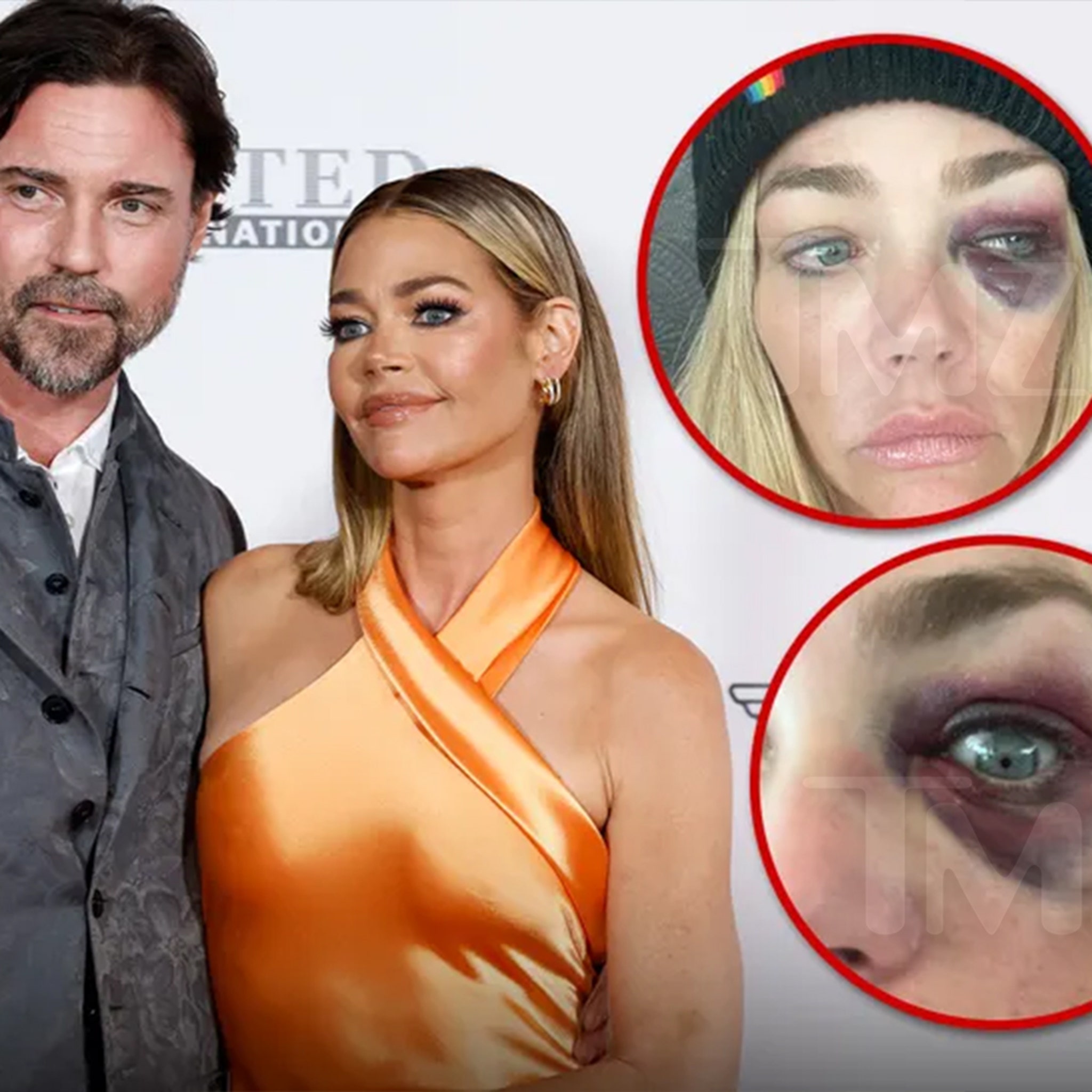 Denise Richards Accuses Estranged Husband of Domestic Violence, Threatening  Her Life