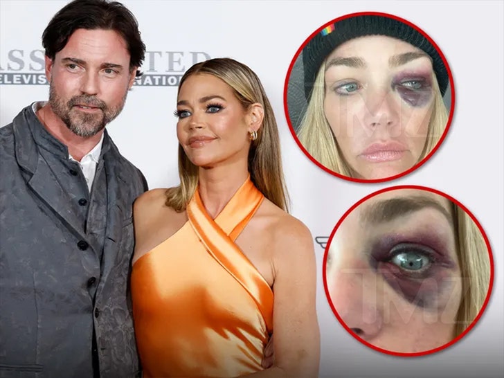 denise ricahrds and Aaron Phypers alleged injuries lawsuit 5