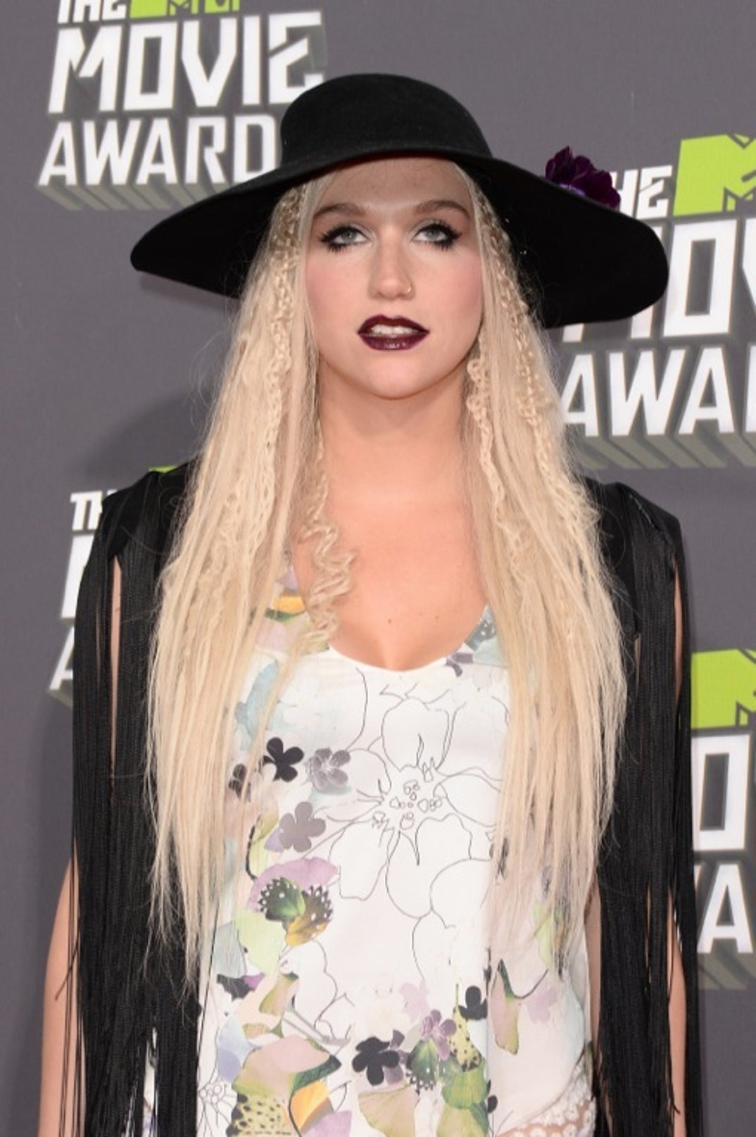 1017_kesha_through_the_years_15