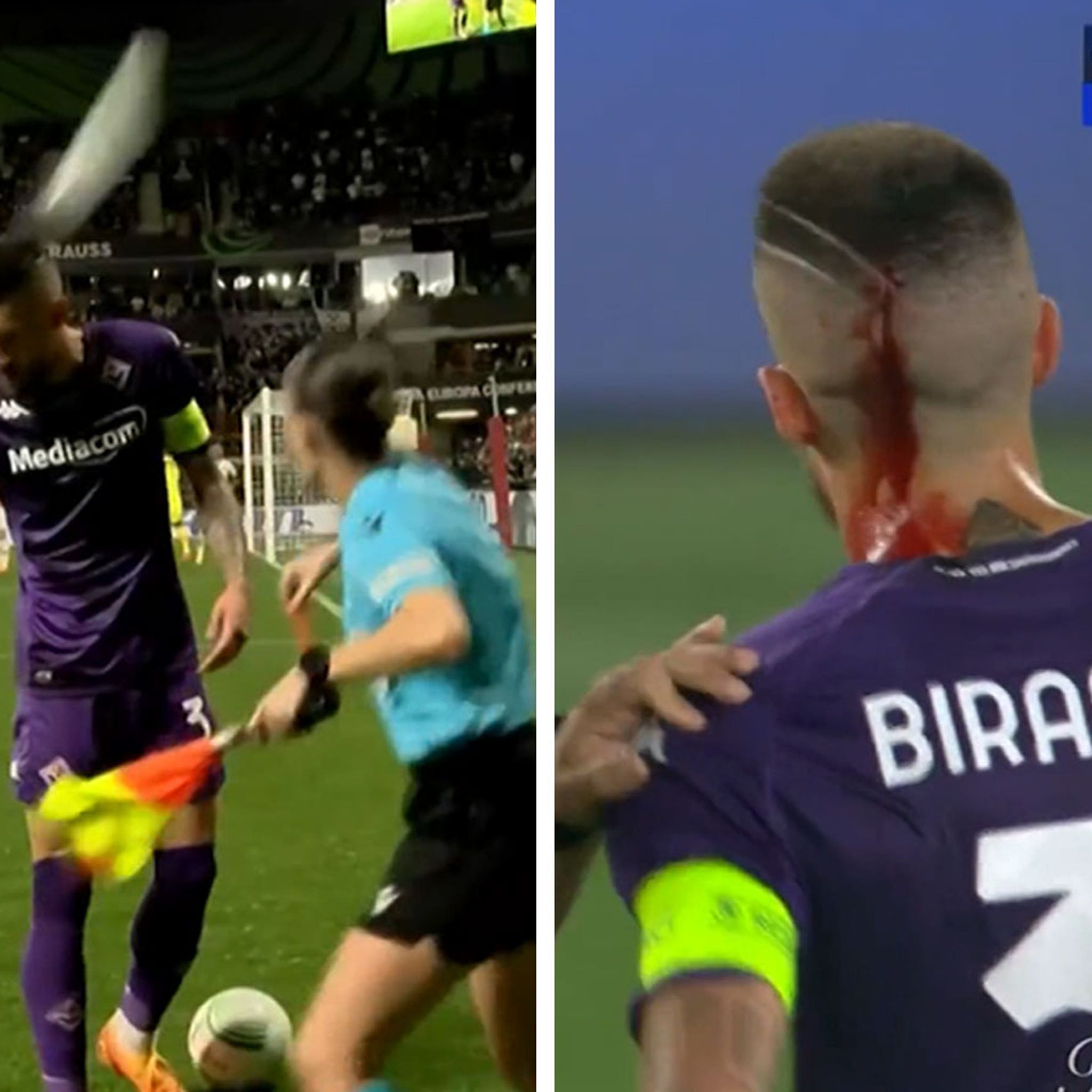 Video Shows Soccer Player Getting Bloody Head Wound After Being Pelted With  Trash by Fans