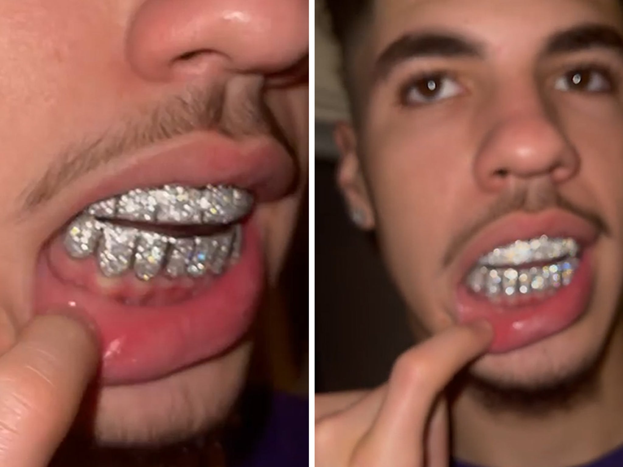 LaMelo Ball Cops Baller Diamond Grill With 14k Welcome To The NBA!