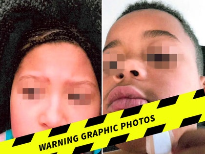 aaron donald kids dog bites WARNING LAUNCH