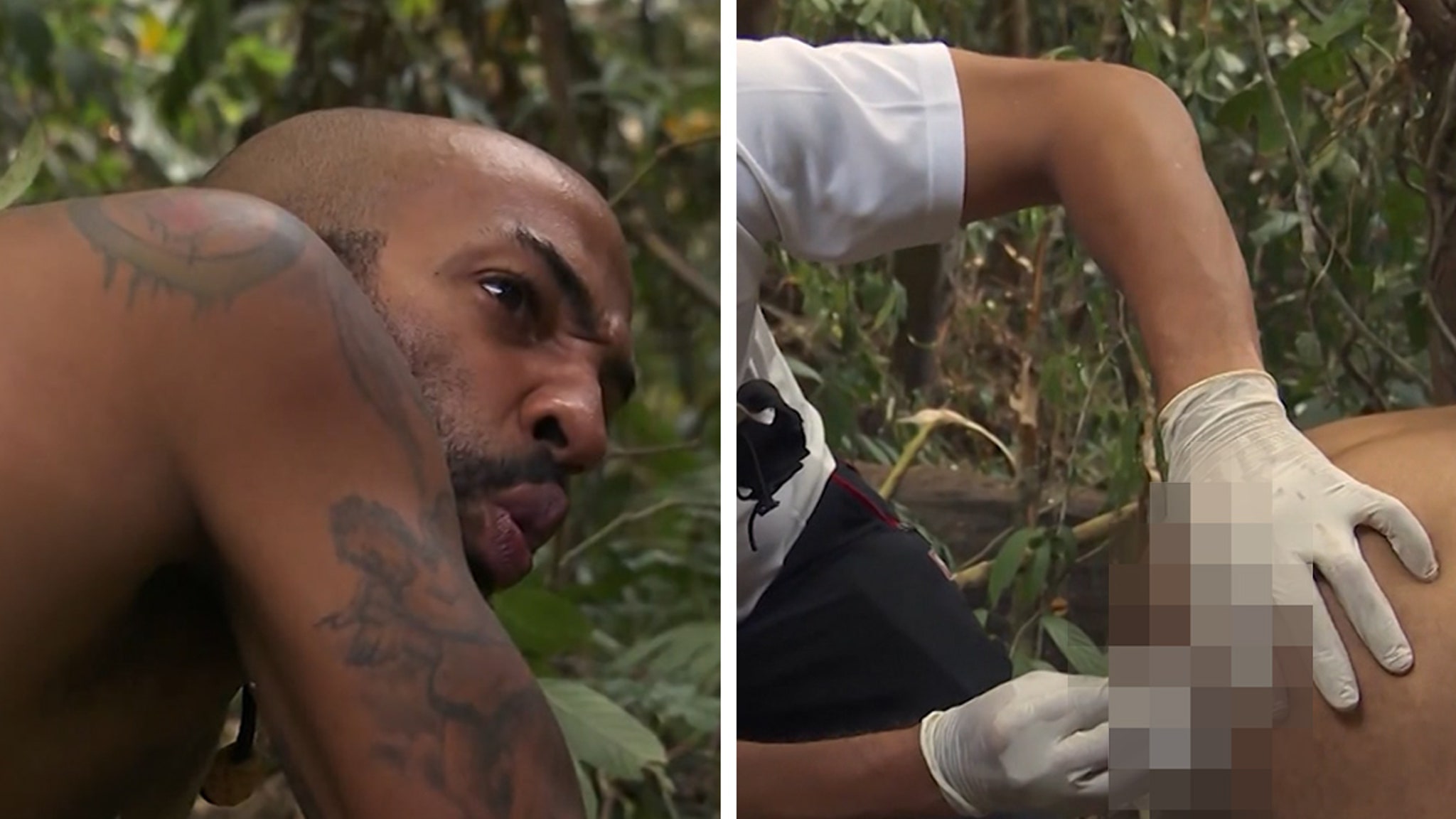 'Naked and Afraid' Contestant Brings Adventure to Painful Stitches Removal