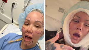 031626 bunnie xo facelift primary