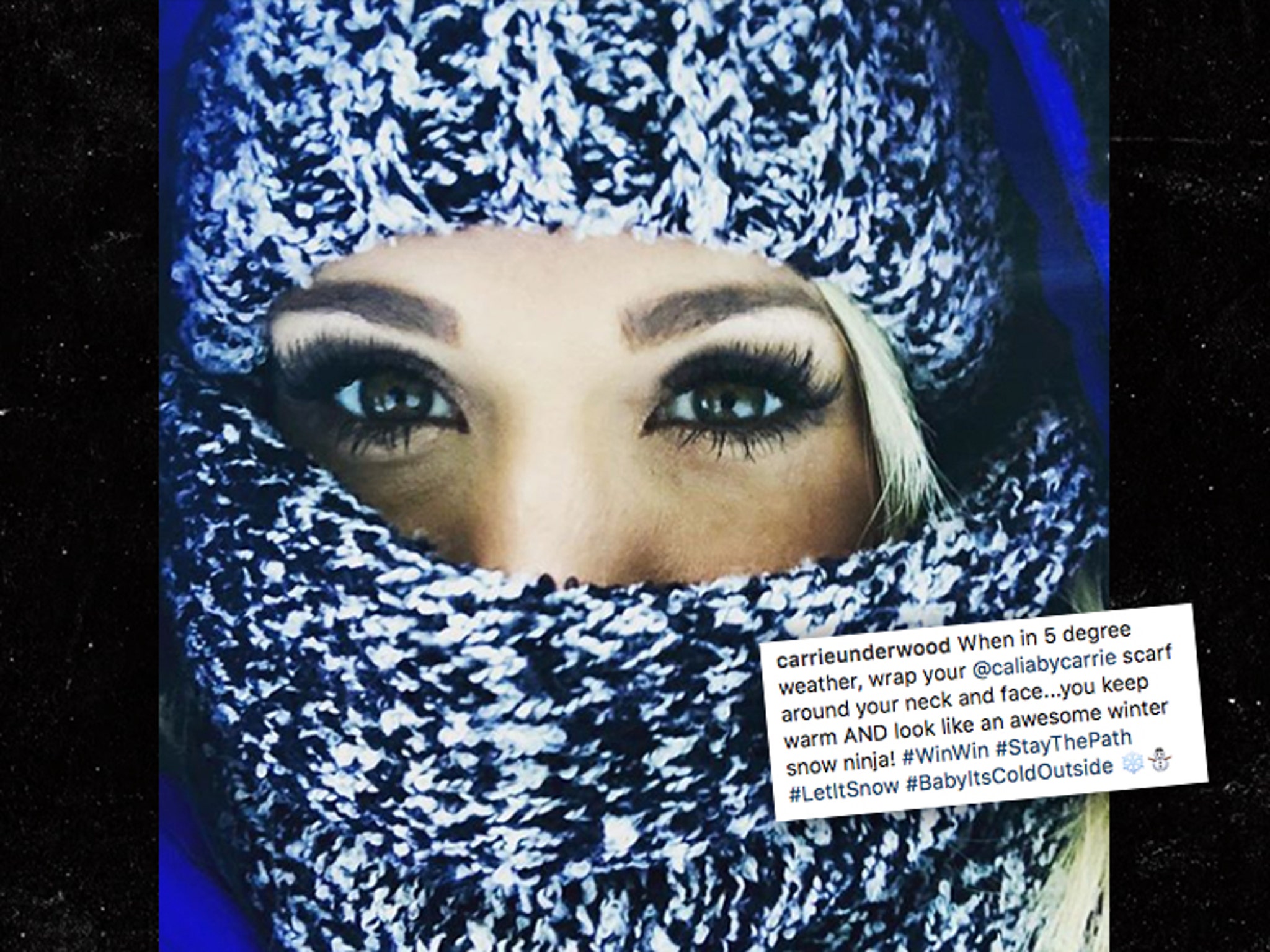 Carrie Underwood Required More Than 40 Stitches in Her Face After Fall