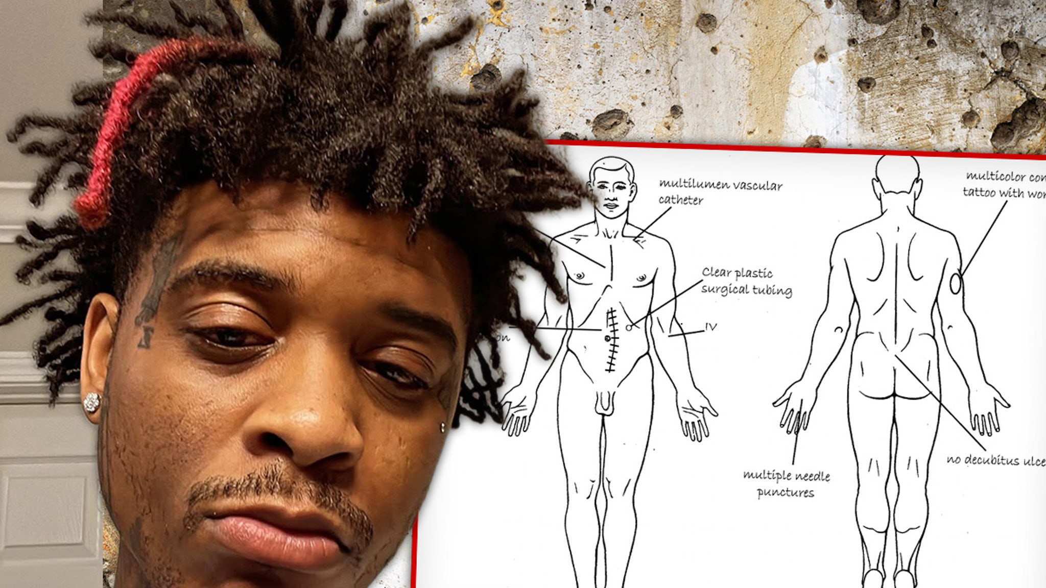 T-Hood Autopsy Confirms Rapper Was Shot at Least Once in the Back