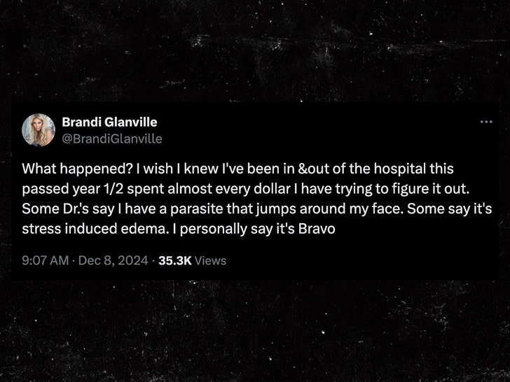 Brandi Glanville health update bravo