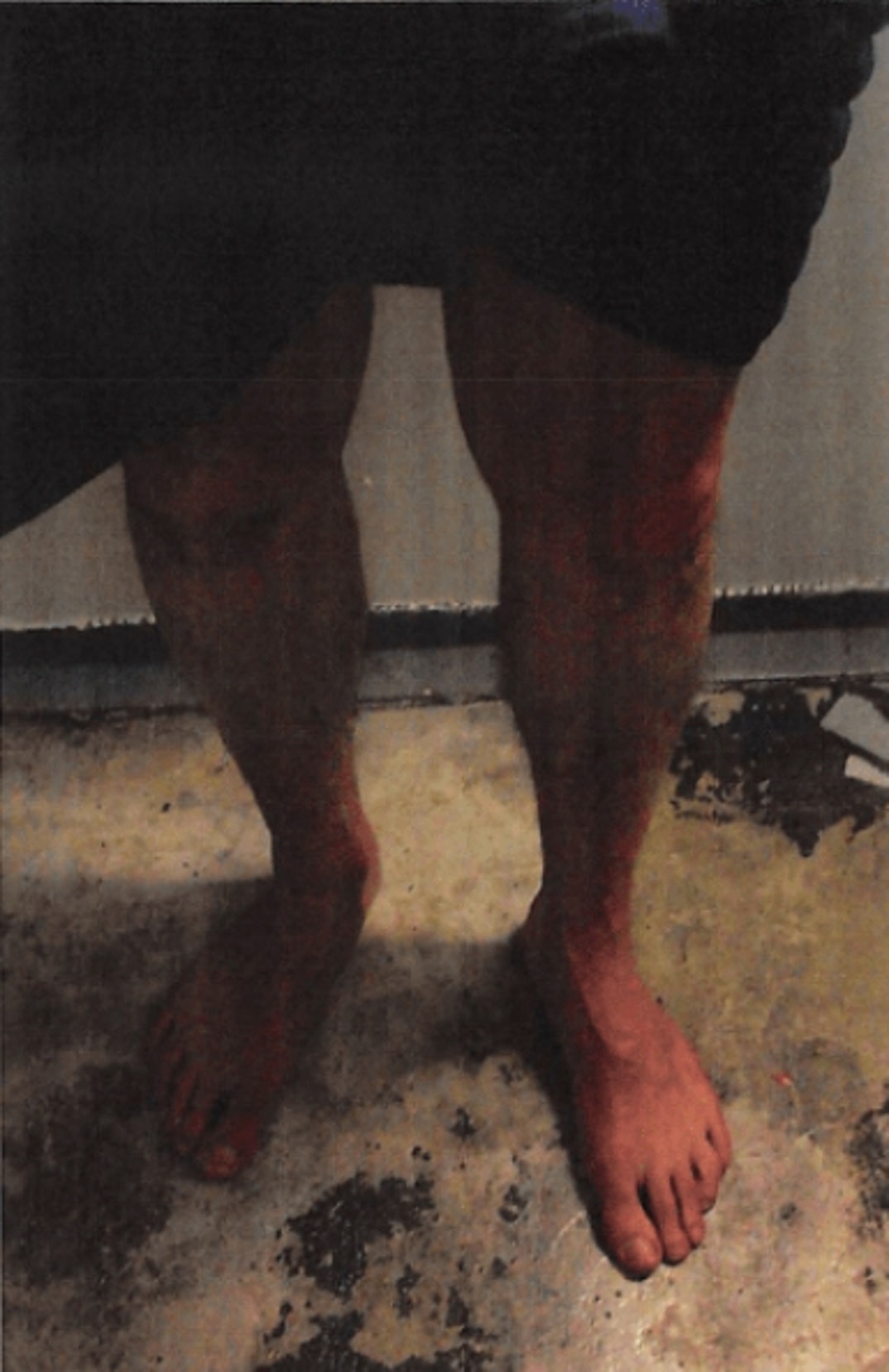 Jeffrey Epstein Lying Down Noose 4