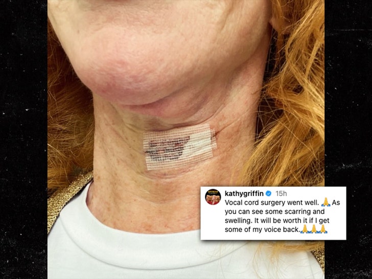 kathy griffin vocal cord