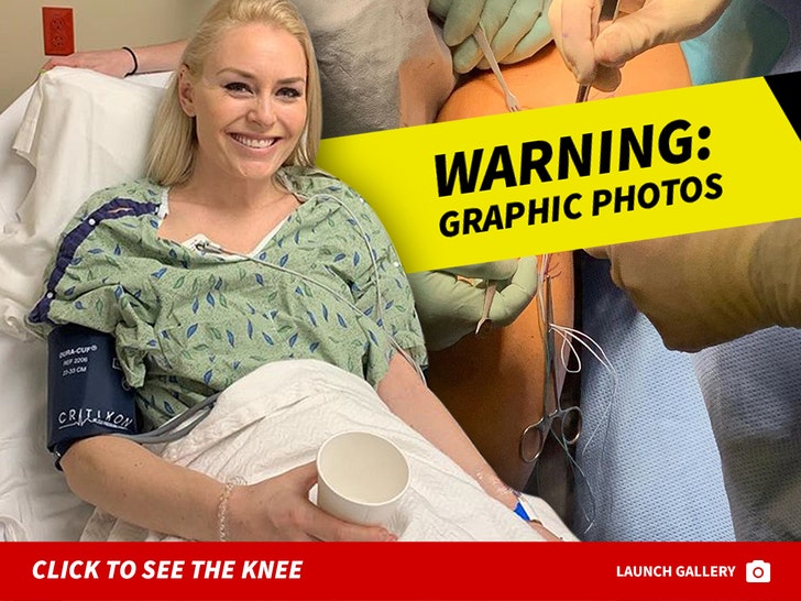 Lindsey Vonn's Gruesome Knee Surgery Photo