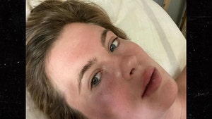Ireland Baldwin Attacked by Crazed Woman on Drugs, Pics of Bruised Face