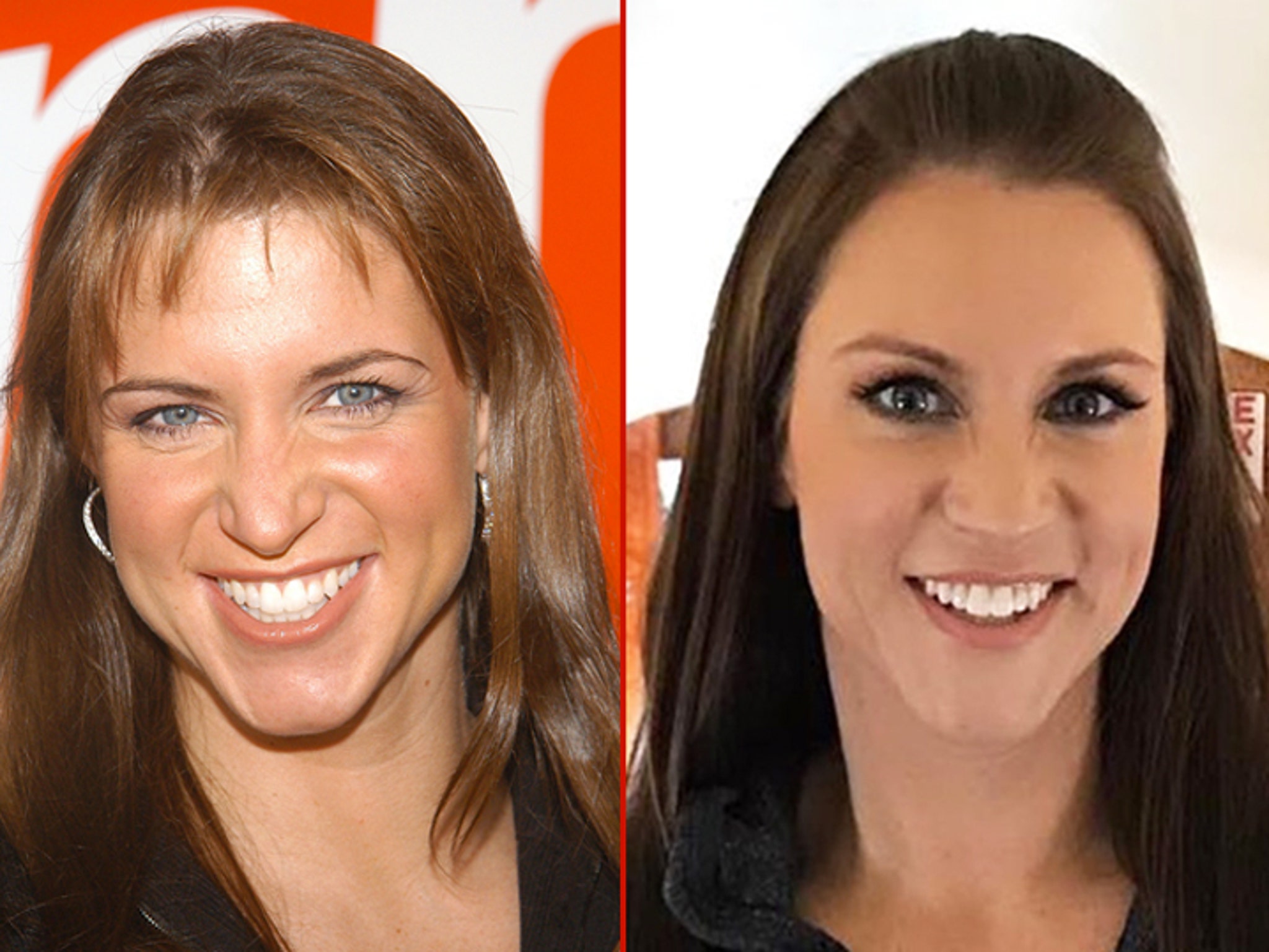 Stephanie McMahon: Good Genes Or Good Docs?