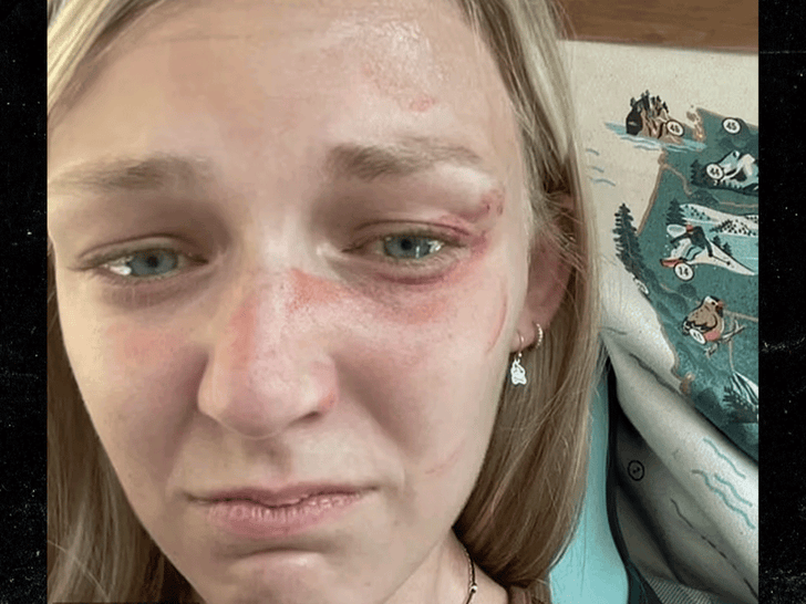 Gabby Petito's Parents Release Selfie Showing Bruised Face Pre-Traffic Stop