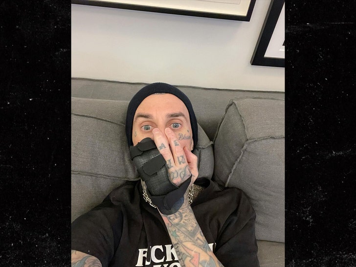 travis barker hand injury insta 2