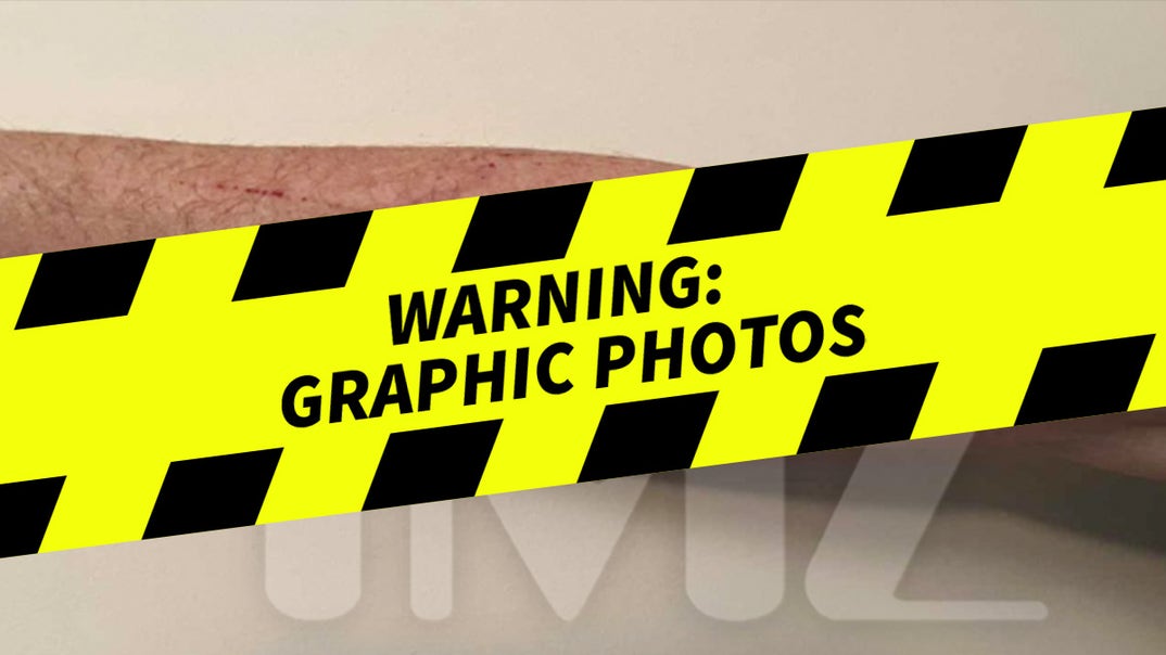 1027-Sunbeam-Sunburns-PRIMARY-watermark