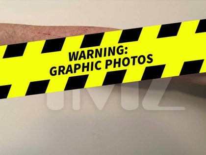 1027-Sunbeam-Sunburns-PRIMARY-watermark