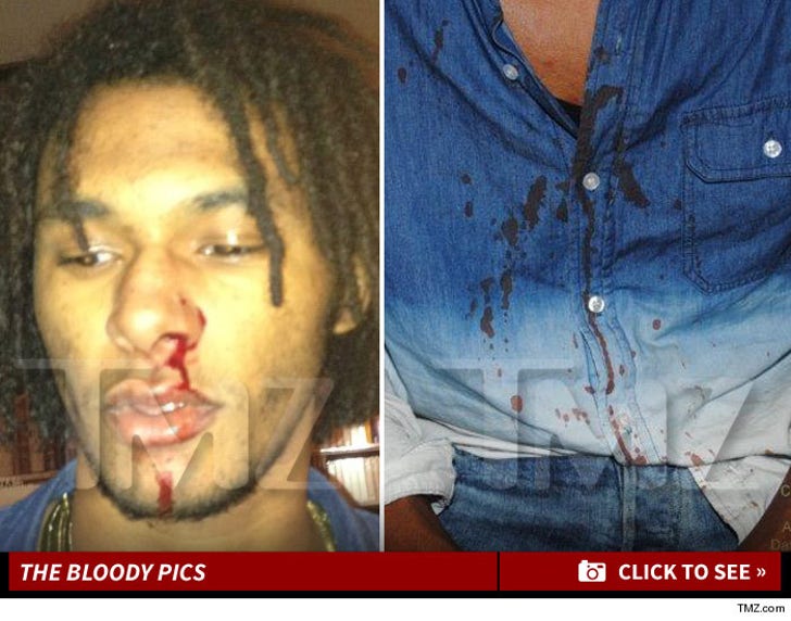 Chris Brown -- BLOODY PHOTOS From Alleged D.C. Beatdown