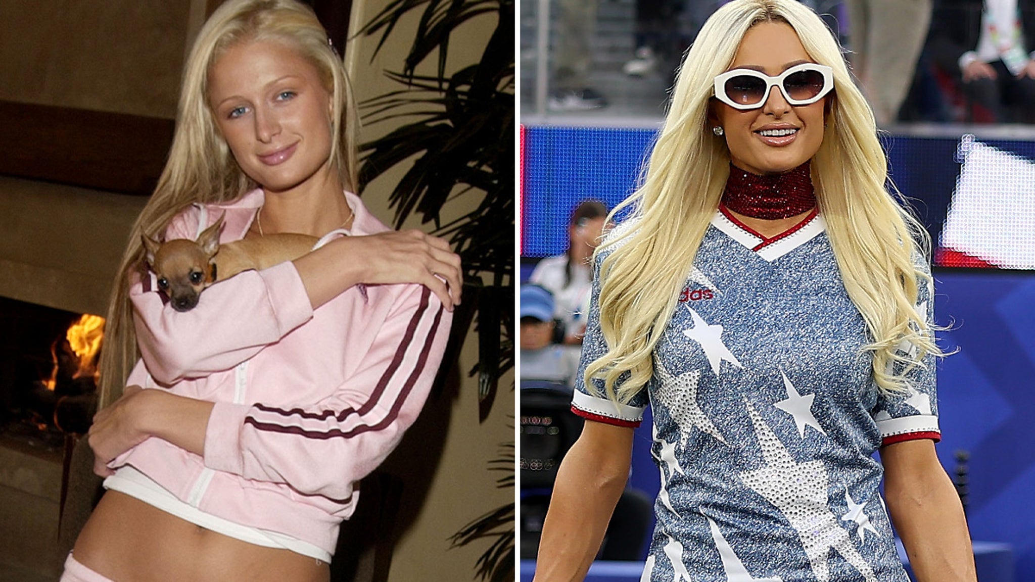 Paris Hilton: Ageless Icon or Secret Surgery Siren?