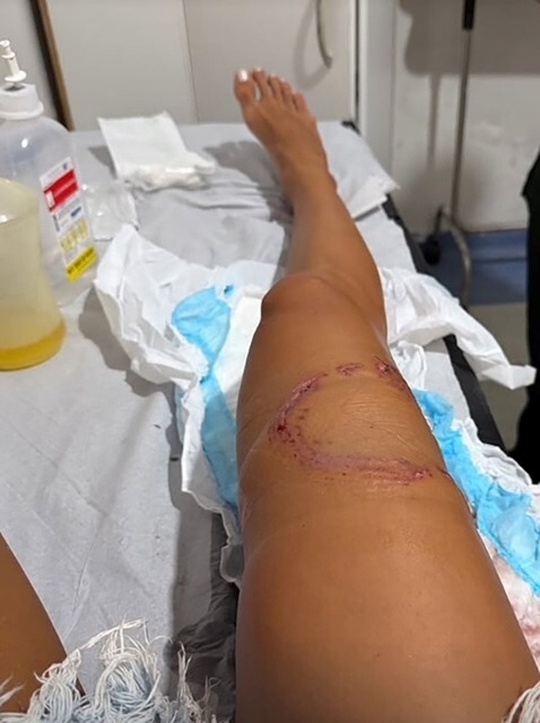 Lawyer Tayane Dalazen Shark Attack 2