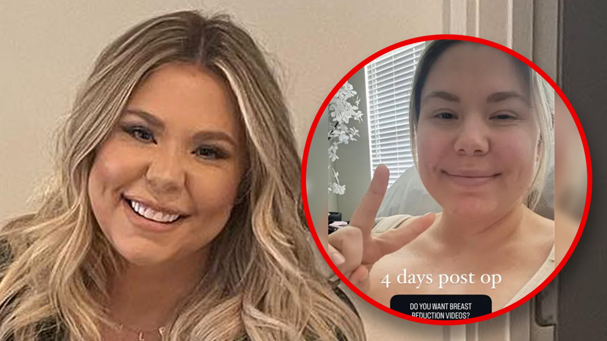 'Teen Mom' Star Kailyn Lowry Reveals She Got Breast Reduction Surgery