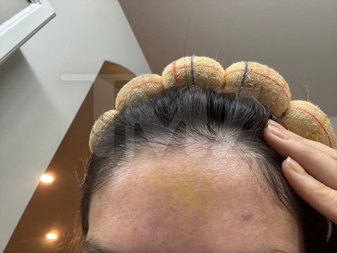 Taylor Frankie Paul Alleged Injuries  2