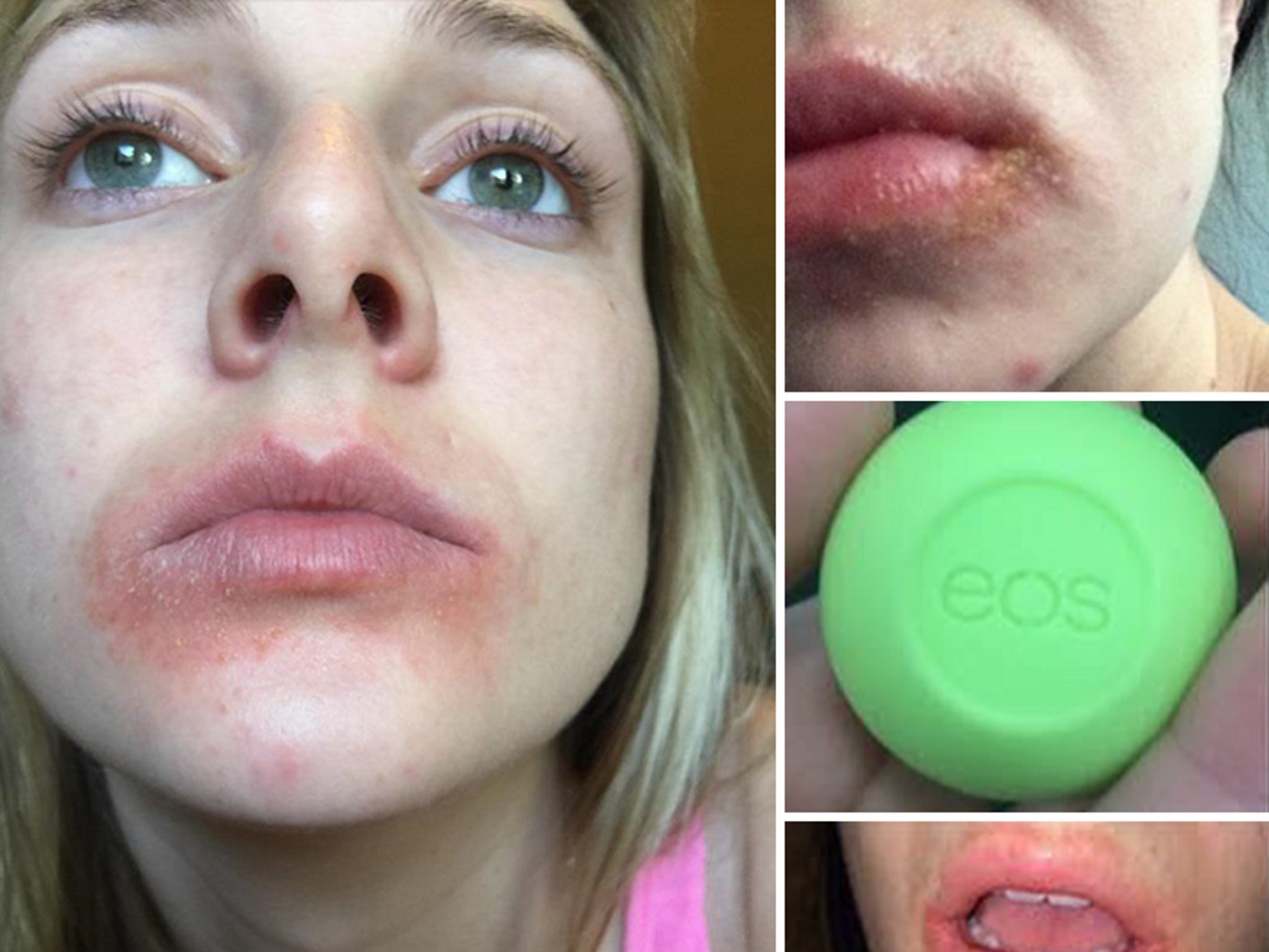 EOS Lip Balm -- Customers Say, 'We'll Give You Lip, In Court!!!' (UPDATE)