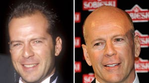 Bruce Willis: Good Genes or Good Docs?