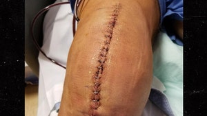 WWE Legend Kevin Nash Shares NASTY Stapled Knee Pic After Surgery