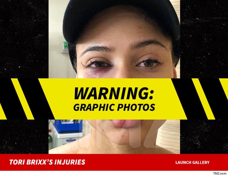 Rich the Kid's GF Tori Brixx Suffers Brutal Face Injury :: 0615-torri-brixx-injury-tmz-wm-launch-7