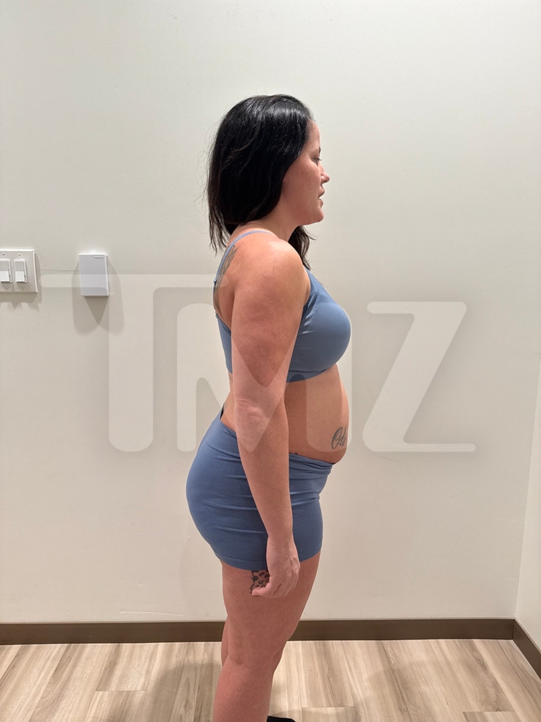 Janelle Evans Mommy Makeover BEFORE  3