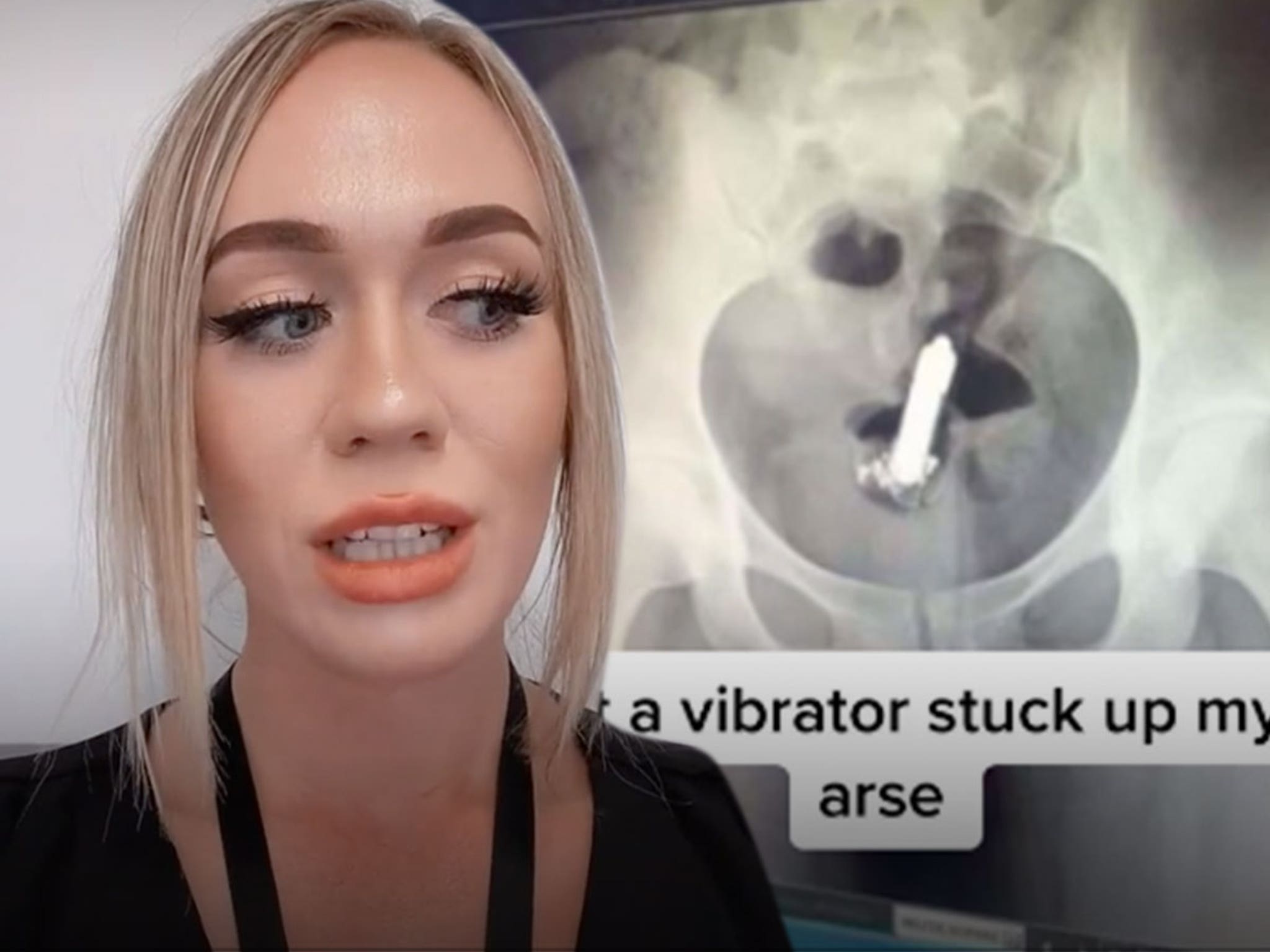 TikTok Star Says She Needed Surgery After Losing Vibrator in Butt pic pic