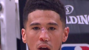 NBA's Devin Booker Busts Nose In On-Court Collision, Gets Stitches and Returns to Game!