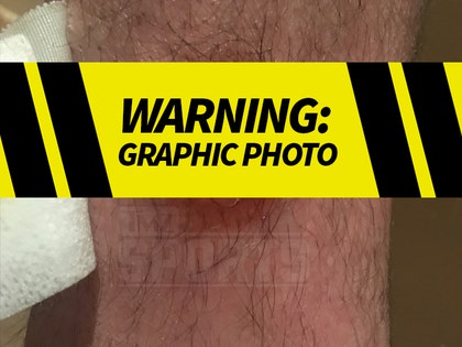 0423-floyd-mayweather-bodyguard-gunshot-wound-launch-primary-01