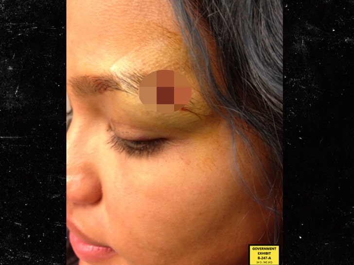 Cassie Cut On Eyebrow
