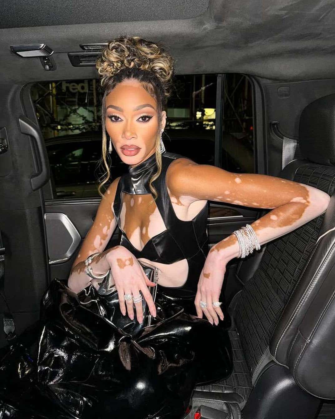 Winnie Harlow