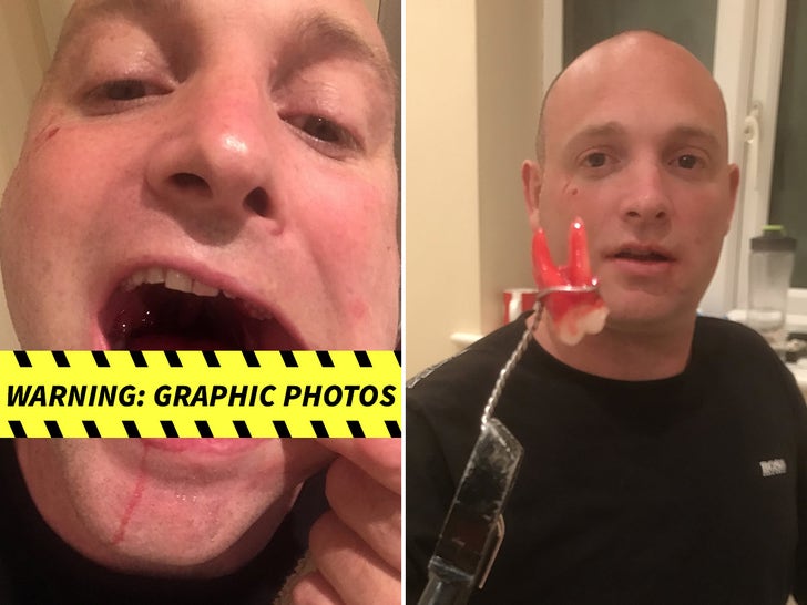 Man Pulls Out His Own Tooth While On Lockdown